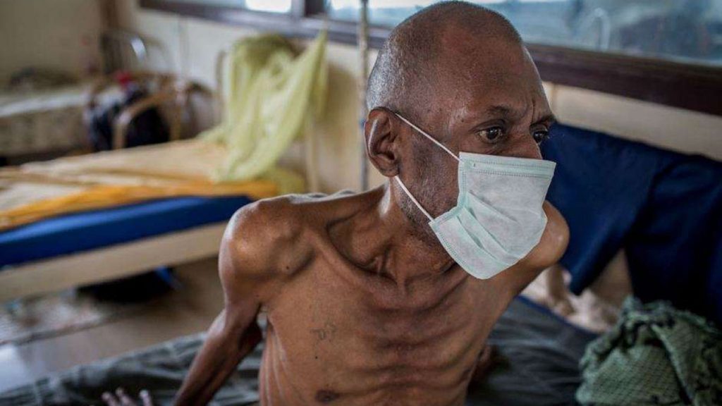 WHO call for cooperation to address tuberculosis